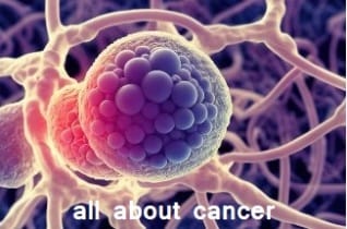 all about cancer : कैंसर बीमारी क्या है , इसका इलाज क्या है जाने इसके बारे में पूरी जानकारी 1 कैंसर बीमारी क्या है , इसका इलाज क्या है