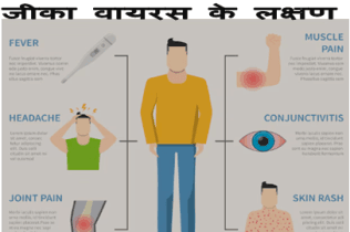 about zika virus : जीका वायरस जानिए इसके लक्षण, कारण और इलाज के बारे में पूरी जानकारी 2 symptoms of zika virus