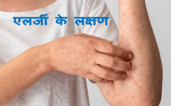 about allergy : देखिये एलर्जी के बारे में पूरी जानकारी 2 symptoms of allergy, about allergy, reason of allergy