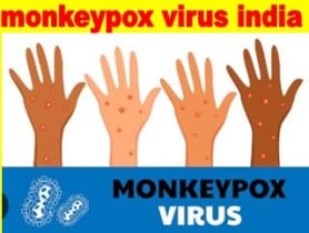 monkeypox virus india